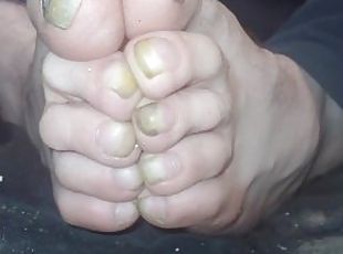 Toenails have gotten long and ugly